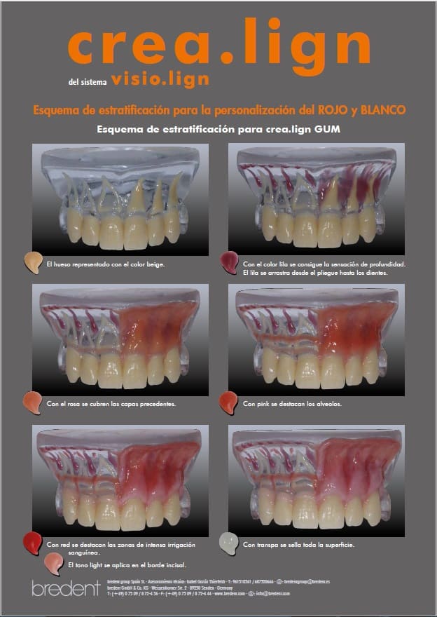 crea.lign Esquema de estratificación para la personalización del ROJO y BLANCO