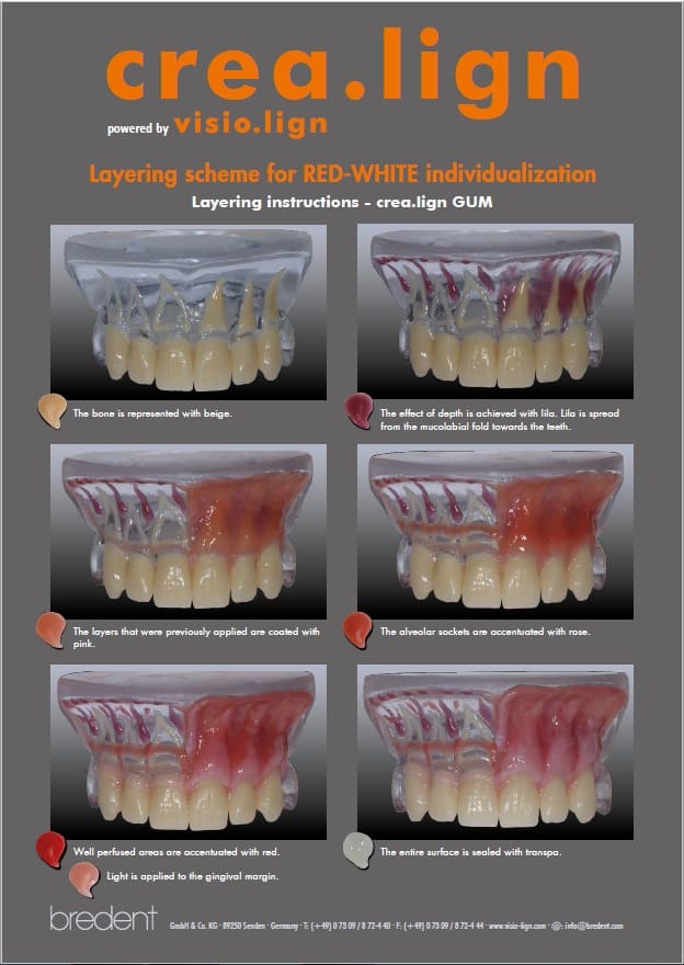 crea.lign GUM RED-WHITE Layering instructions