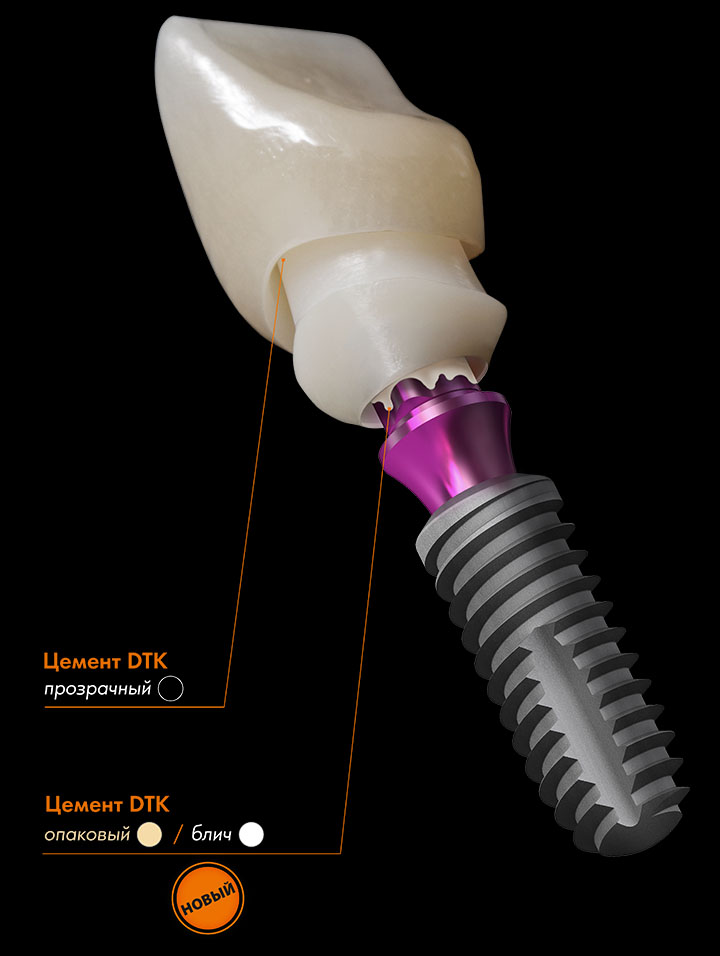 veneering composite photo